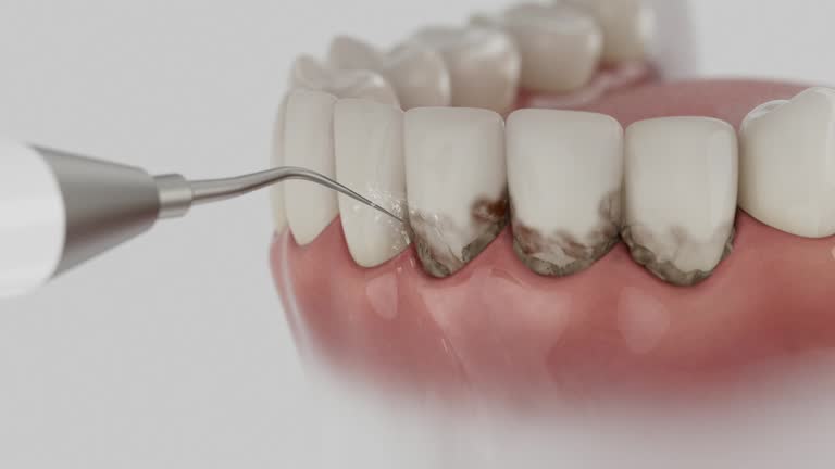 Trusted Teeth Whitening service in Brownfield, TX - Dentist Open Now